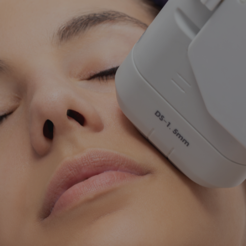 Zen Luxe Med Spa Aesthetic Services with Injector Resha A woman is getting High-Intensity Focused Ultrasound (HIFU) on her face.