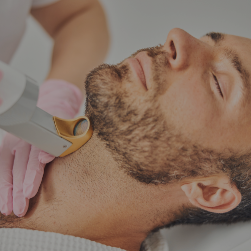 Zen Luxe Med Spa Aesthetic Services with Injector Resha A man with a beard getting a laser hair removal treatment.