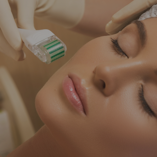 Microneedling at Zen Luxe Med Spa Aesthetic Services with Injector Resha