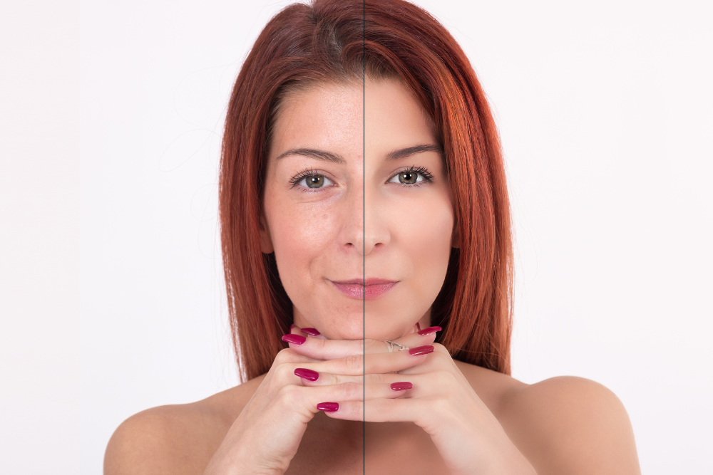 a before and after women who is trying the peptide therapy findings 