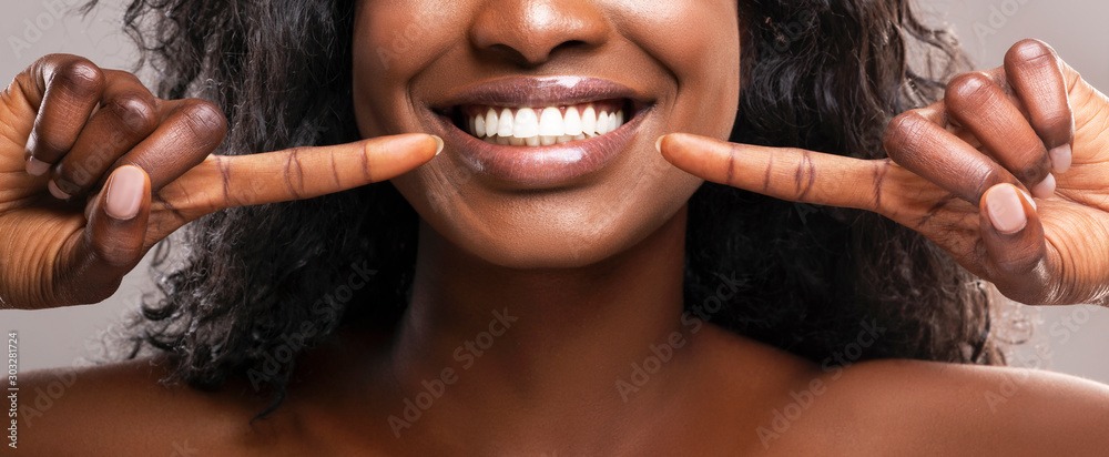 Unrecognizable black woman pointing at her healthy white teeth, closeup