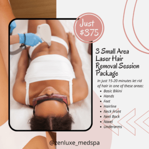 3 small area laser treatment package