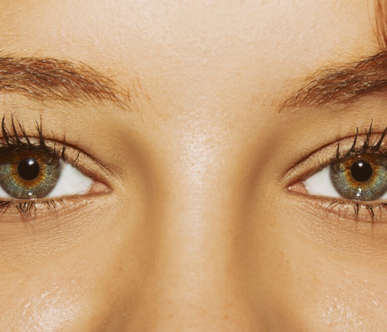 PRP Under Eye Treatment | Brighten & Rejuvenate Your Eyes at Zen Luxe Med Spa